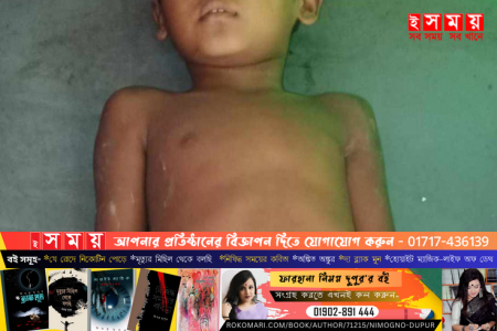পাথরঘাটায় অটোরিকশা চাপায় শিশু নিহত    